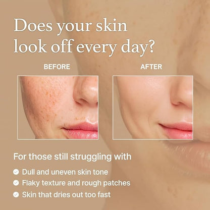 EXOTIQLIFE Rice Toner - Brightening Korean Milky Rice Toner with Niacinamide for Glass Skin